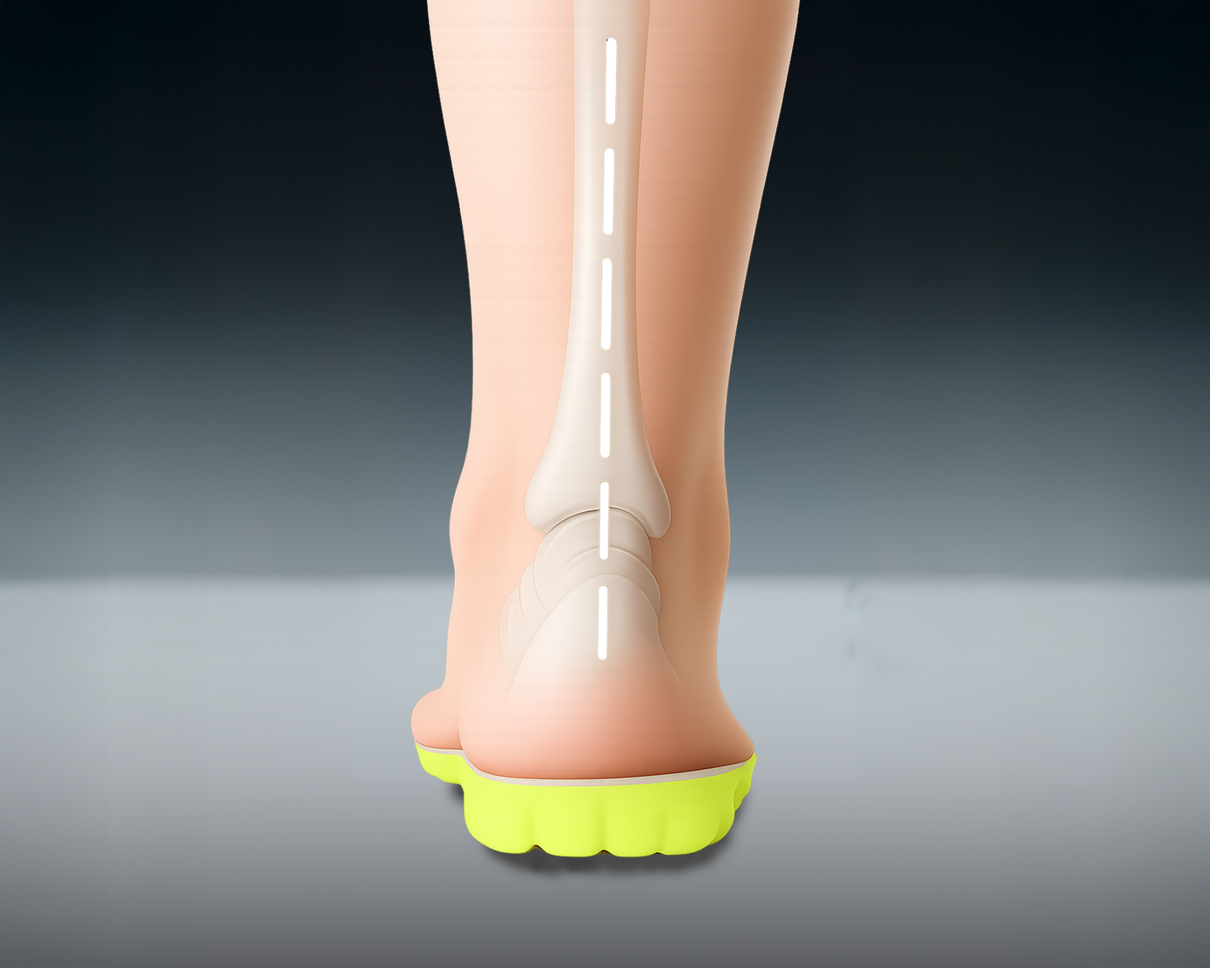 Foot alignment after correction